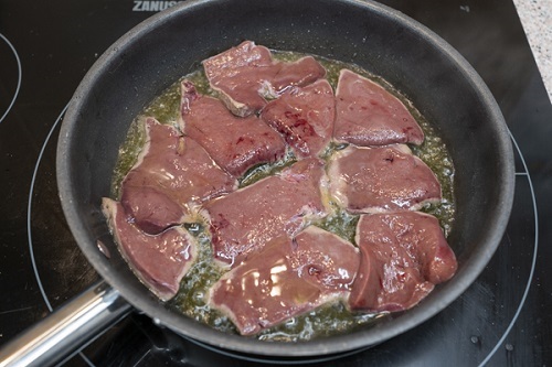 Hígado encebollado Hígado encebollado